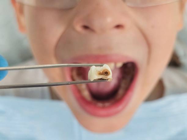 Best Weekend Emergency Dentist in Melrose, MN